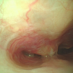 猫の鼻腔内炎症